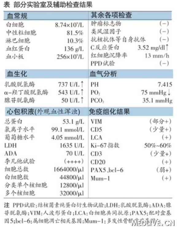 B细胞淋巴瘤