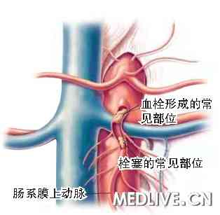 ASMAT 和ASMAE 的常见部位