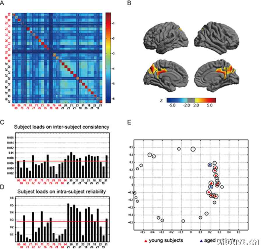 中科院开发神经影像数据挖掘新方法