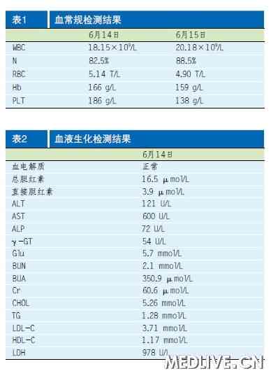 疑似急性重症病毒性tag data-tag=