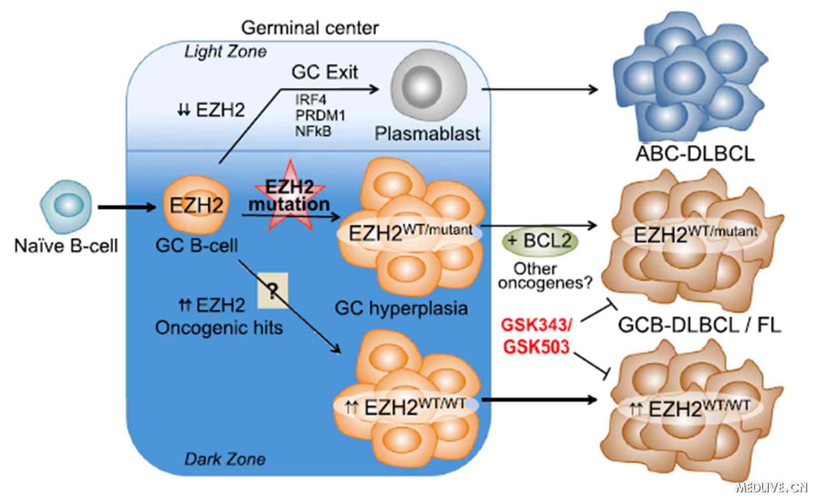 生发中心B细胞EZH2基因正常与异常表达