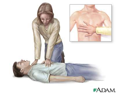 cardiopulmonary-resuscitation-2568_2.jpg