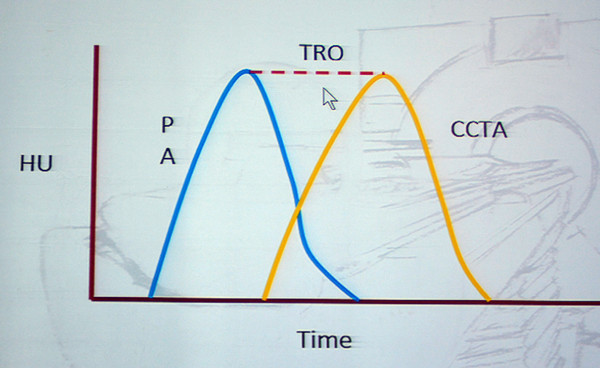 图1 TRO对比剂注射时机示意图