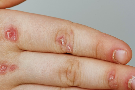 1565314026337780.png 微信图片_20190809092602.png