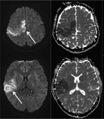 1571383987347125.jpg 10.20.1.jpg