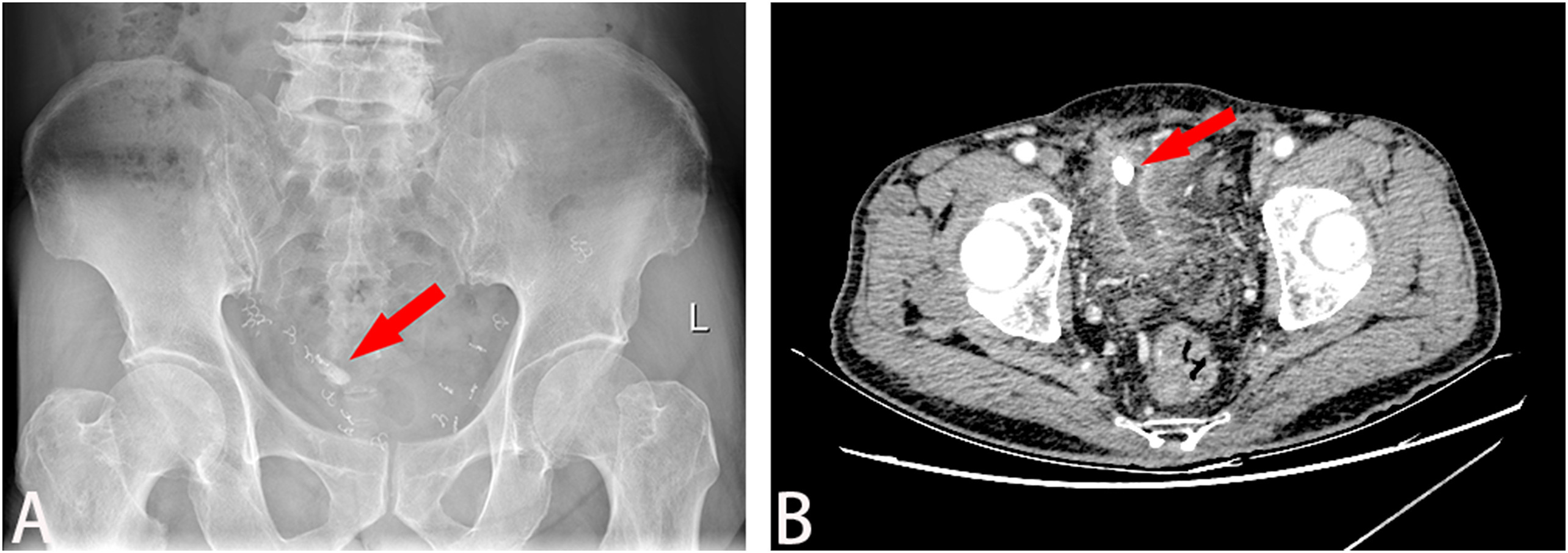 1573031257929317.jpg 1573031257929317.jpg