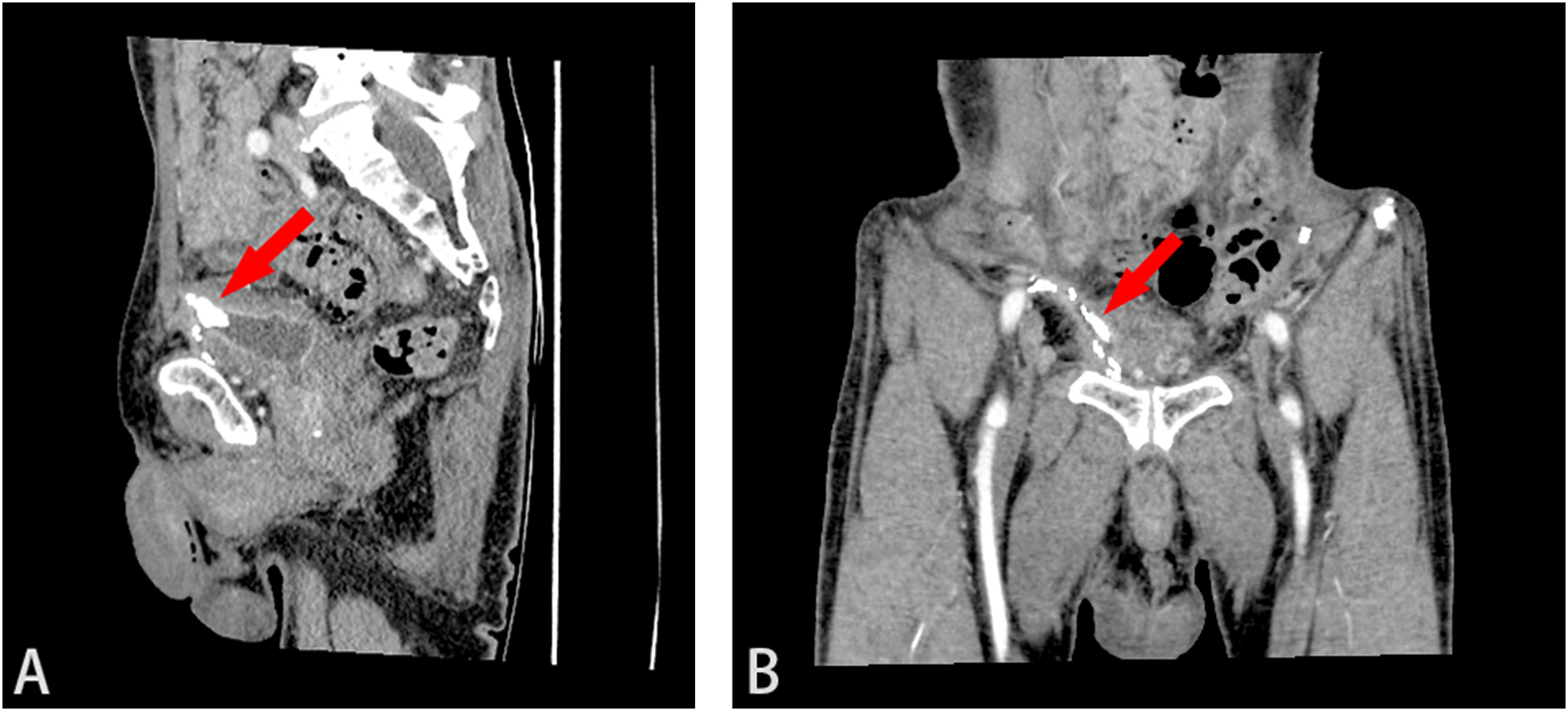 1573031282762116.jpg 1573031282762116.jpg