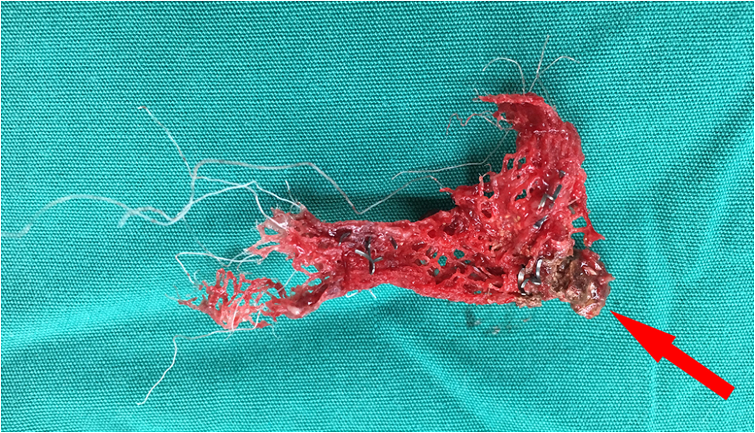 1573031306135113.jpg 1573031306135113.jpg