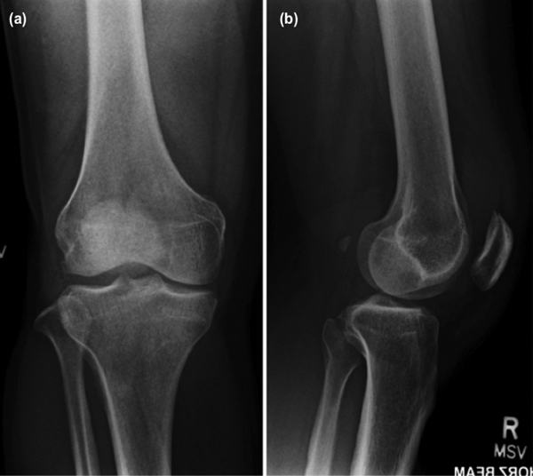 1574840156673582.jpg 1574840156673582.jpg