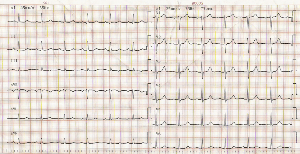 1575881362809617.png 1575881362809617.png