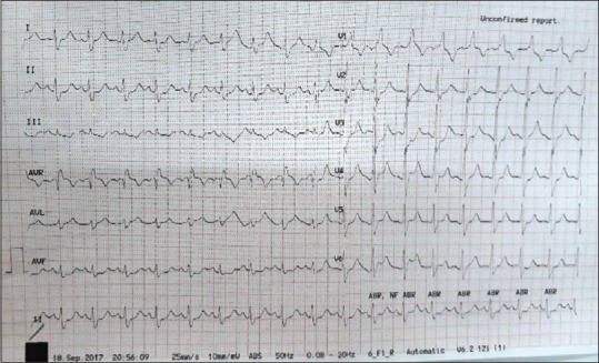 1575881415724233.jpg 1575881415724233.jpg