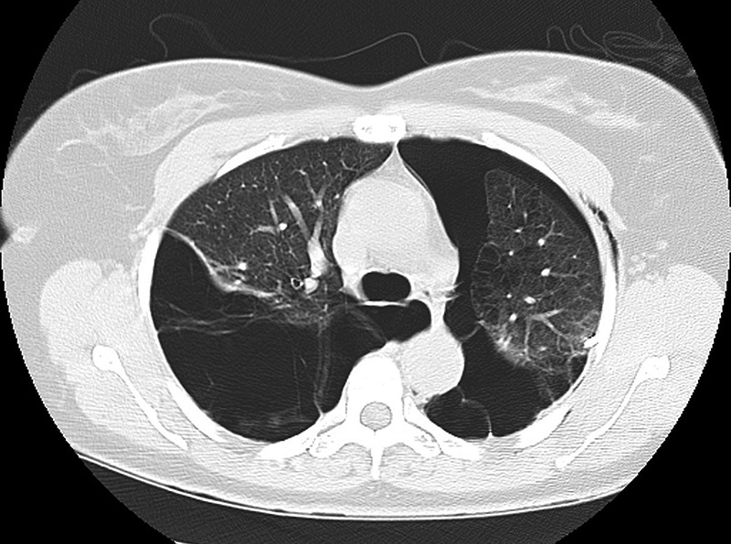 1575881470125801.png 1575881470125801.png