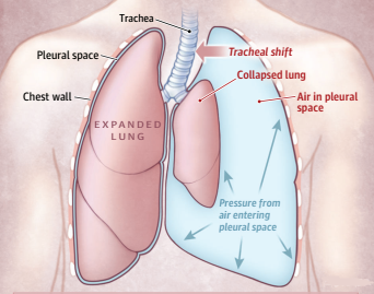 1575881854312245.png 1575881854312245.png