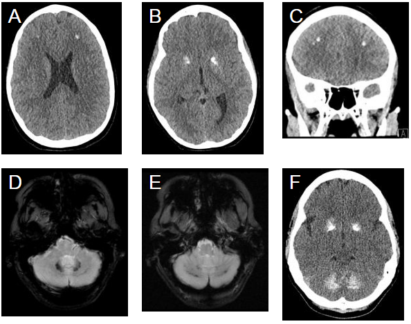 1578023779670718.png AJNR图1.png