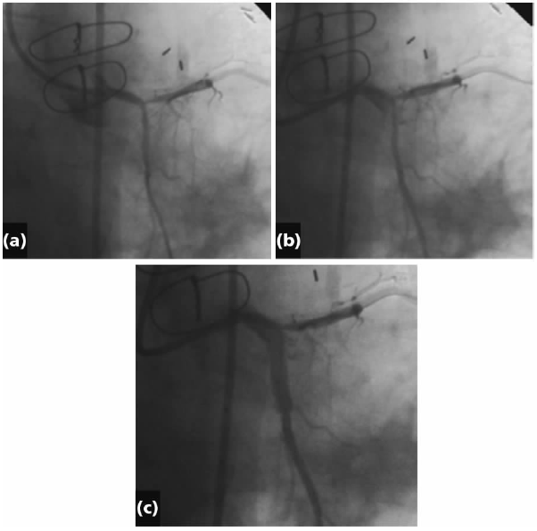 1578891953427376.png 1.PNG