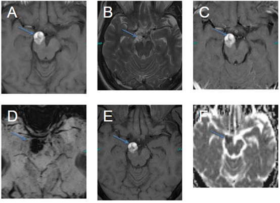 1589638425456990.png 640.png