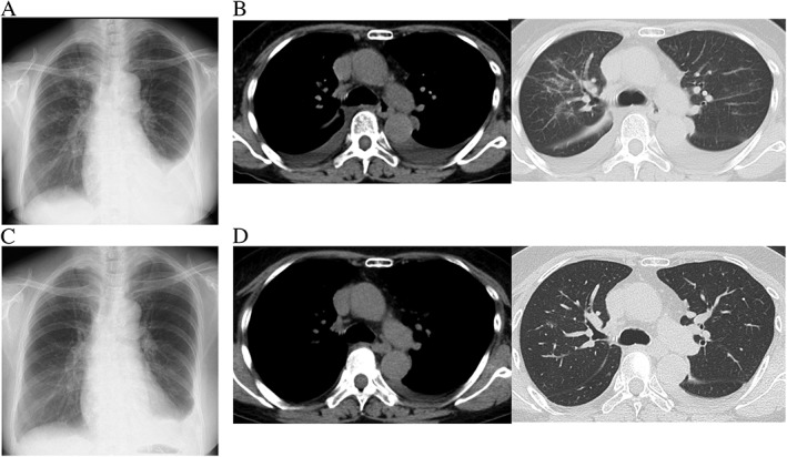 1592894627179269.jpg RCR2-6-e00285-g001.jpg