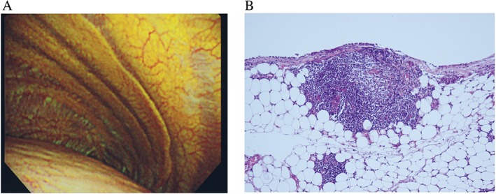 1592894640711070.jpg RCR2-6-e00285-g002 (1).jpg