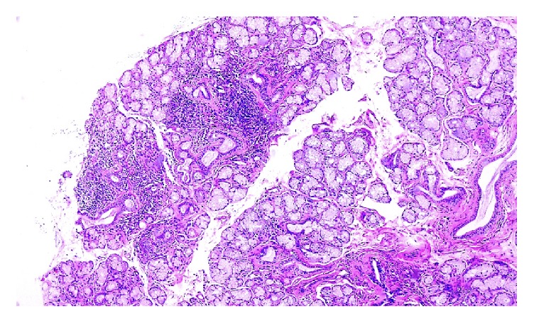 1594194473750505.jpg CRIRH2017-7509238.001.jpg