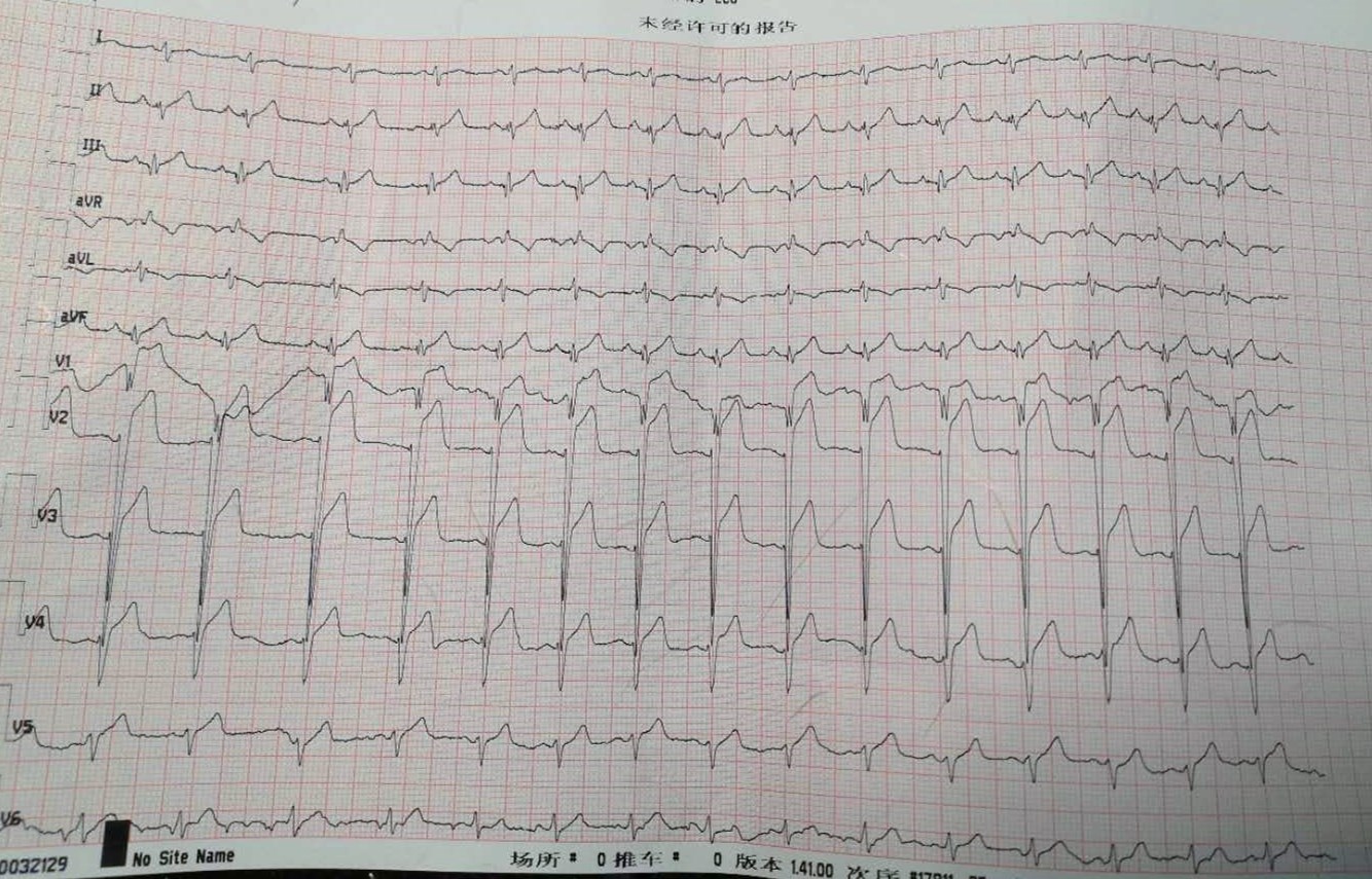 1595922715125875.jpg 1595922715125875.jpg