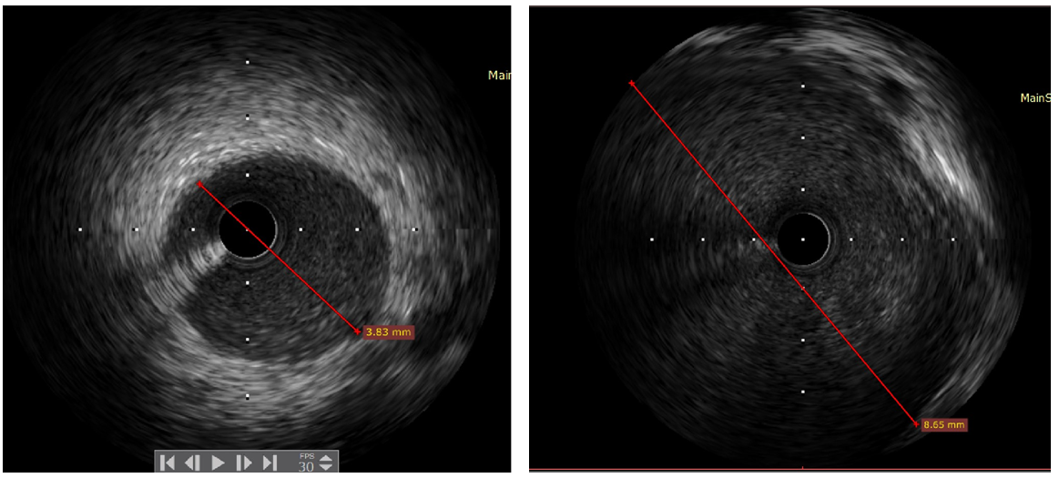 1595922951584383.png 1595922951584383.png