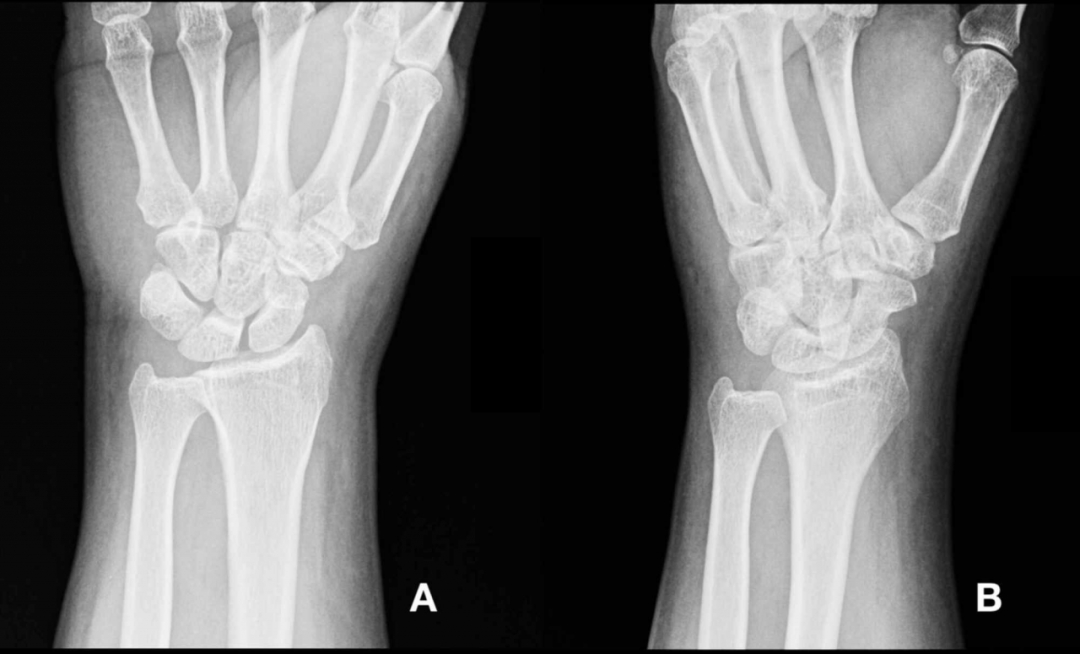 1598436138654966.jpg 1598436138654966.jpg