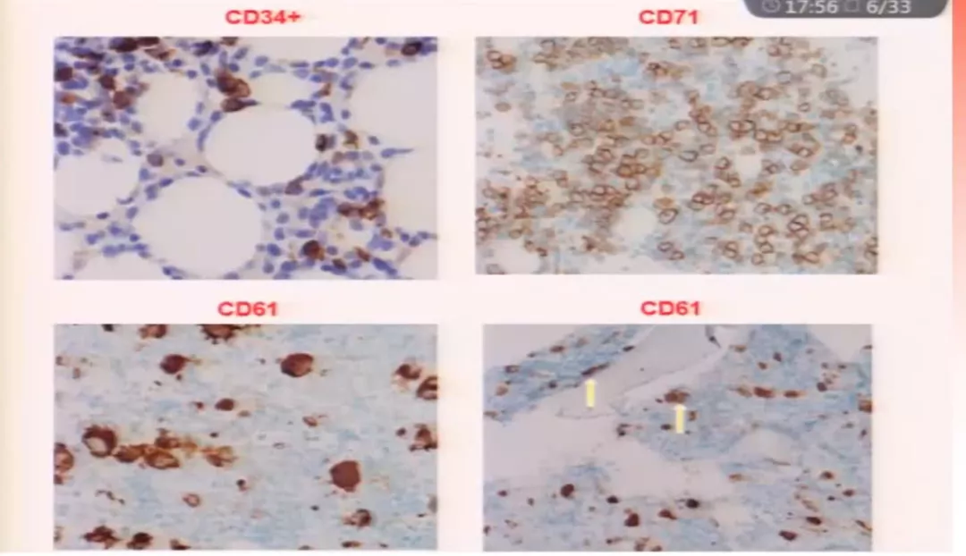 1604392064982693.png 2.png