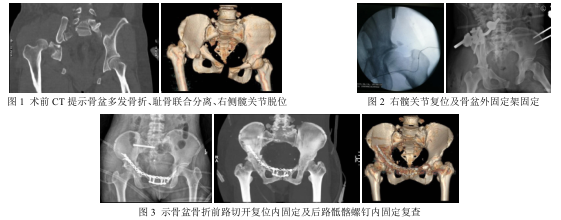 1606451694308040.png 图1.png