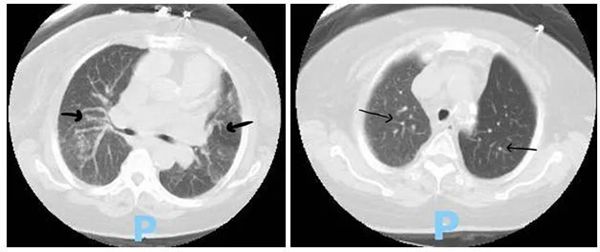 1611647946411624.jpg 图1.jpg