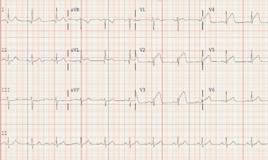 1612854490898322.png 1612854490898322.png