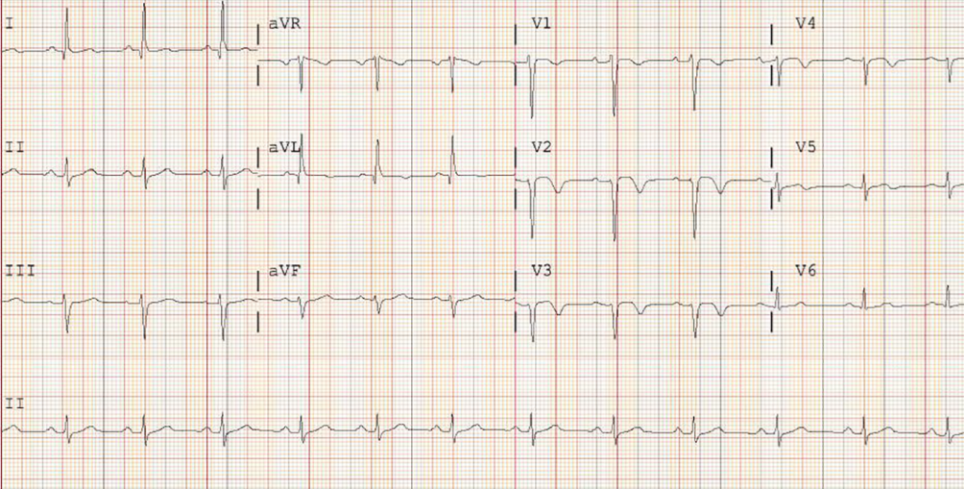 1612854534833175.png 1612854534833175.png