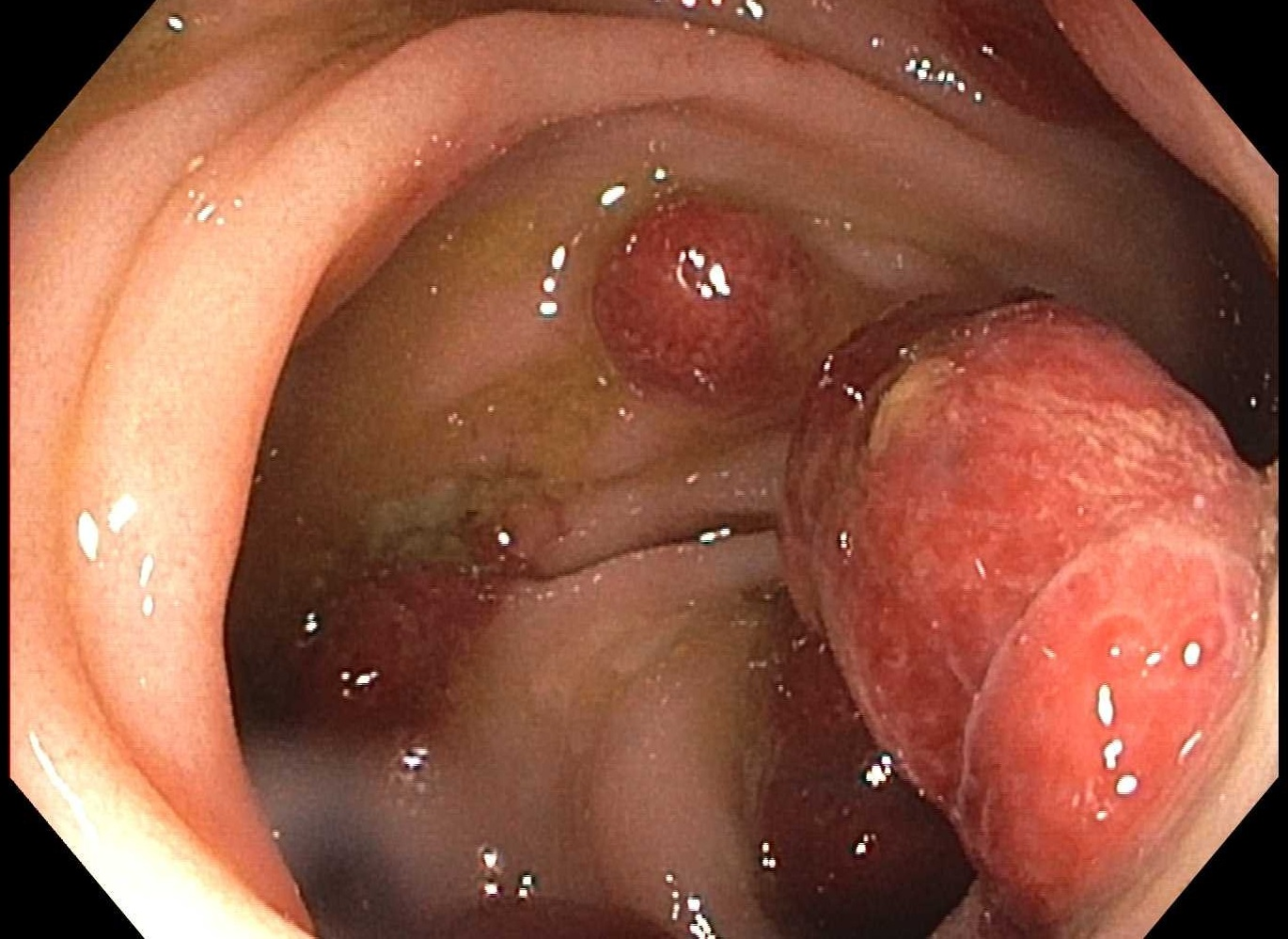 1631267946695038.png 图片.png