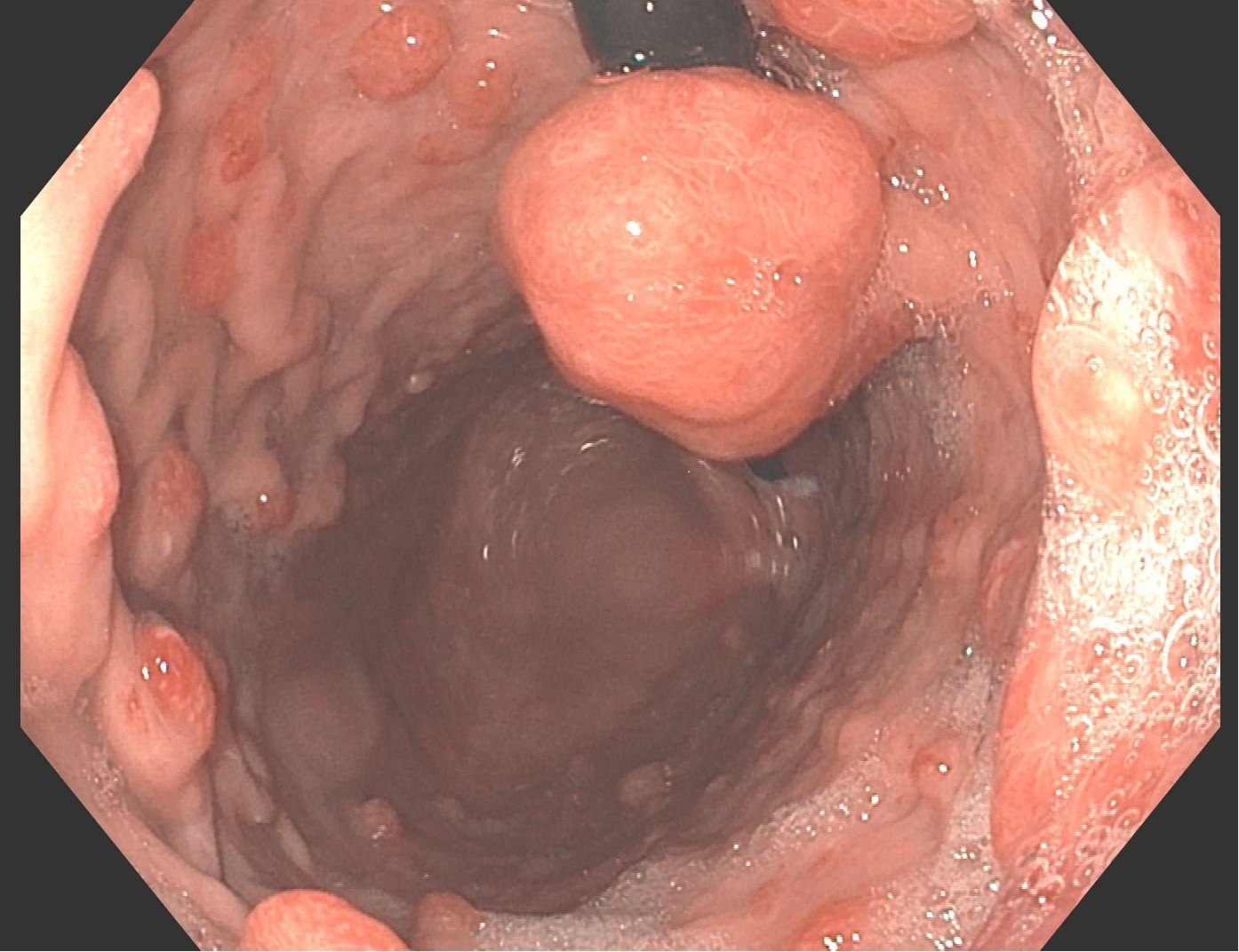 1631267971324240.png 图片3.png