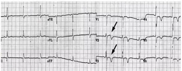 1639969233964661.png 图片6.png