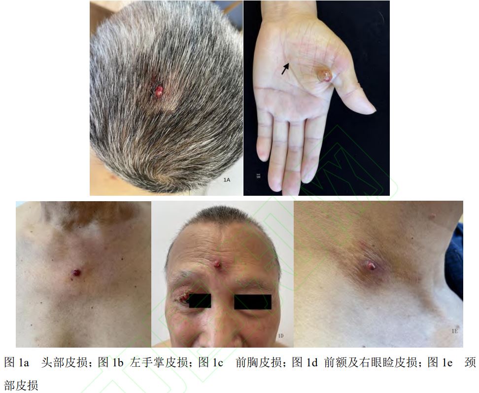 1647754575183226.jpg 1647754575183226.jpg