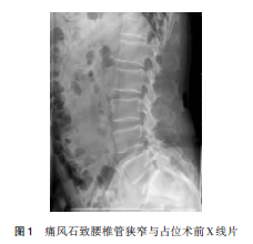 图1.png