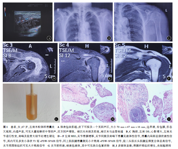 1653874918517757.png 图1.png