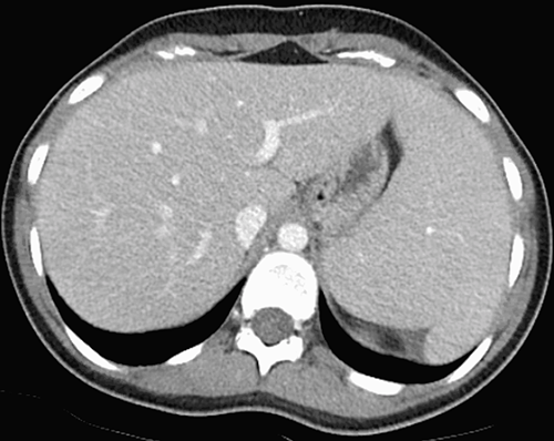 1653909590933221.png 微信图片.png