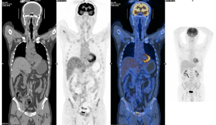 1657108993743839.png 图片5.png