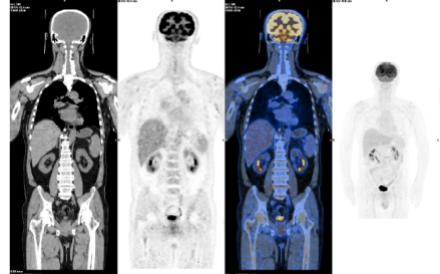 1657109011160003.png 图片6.png