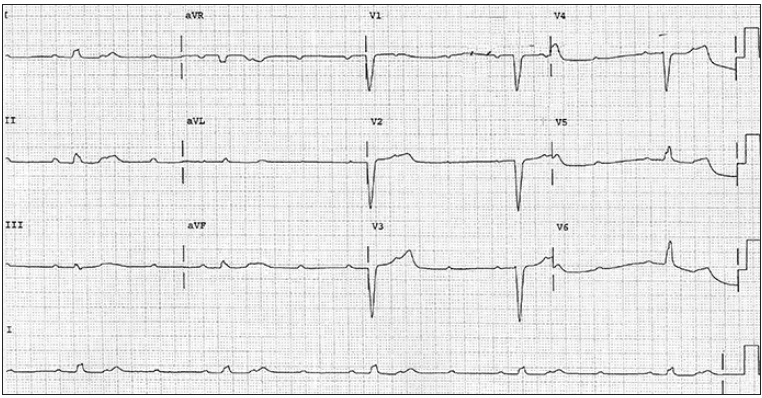 1672122951203840.png 111.PNG