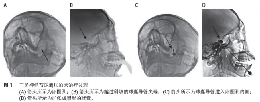 1684969876972152.png 1684969876972152.png