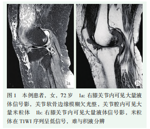 图1.png