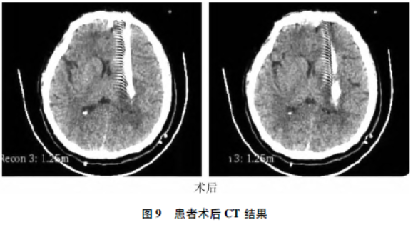 1690245062830984.png