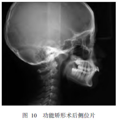 10.png