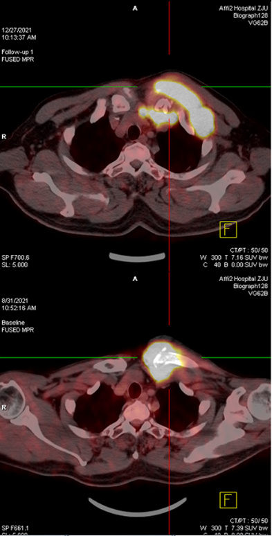 1699934017813704.png 1699934017813704.png