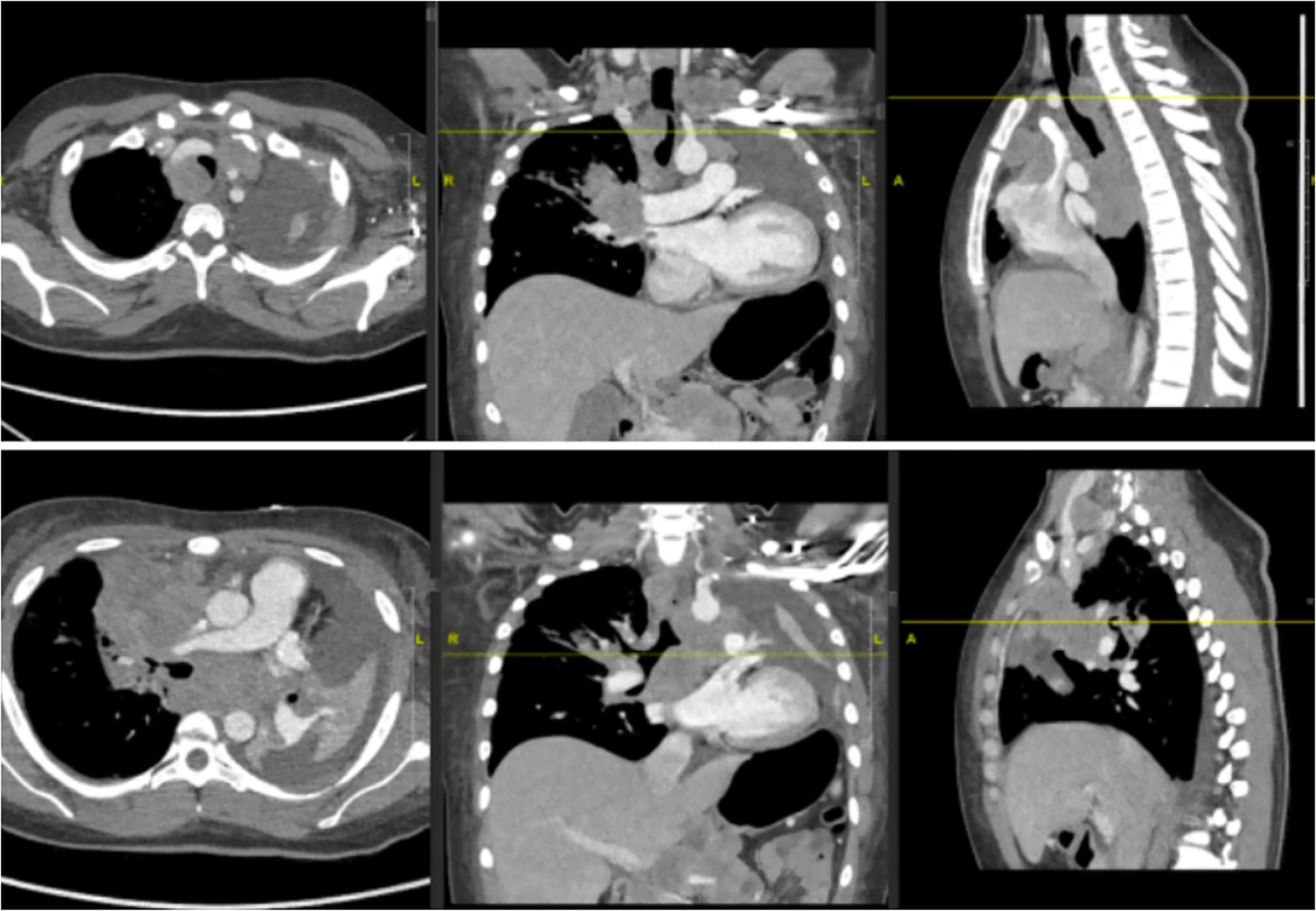 1702958229565944.png 2.png