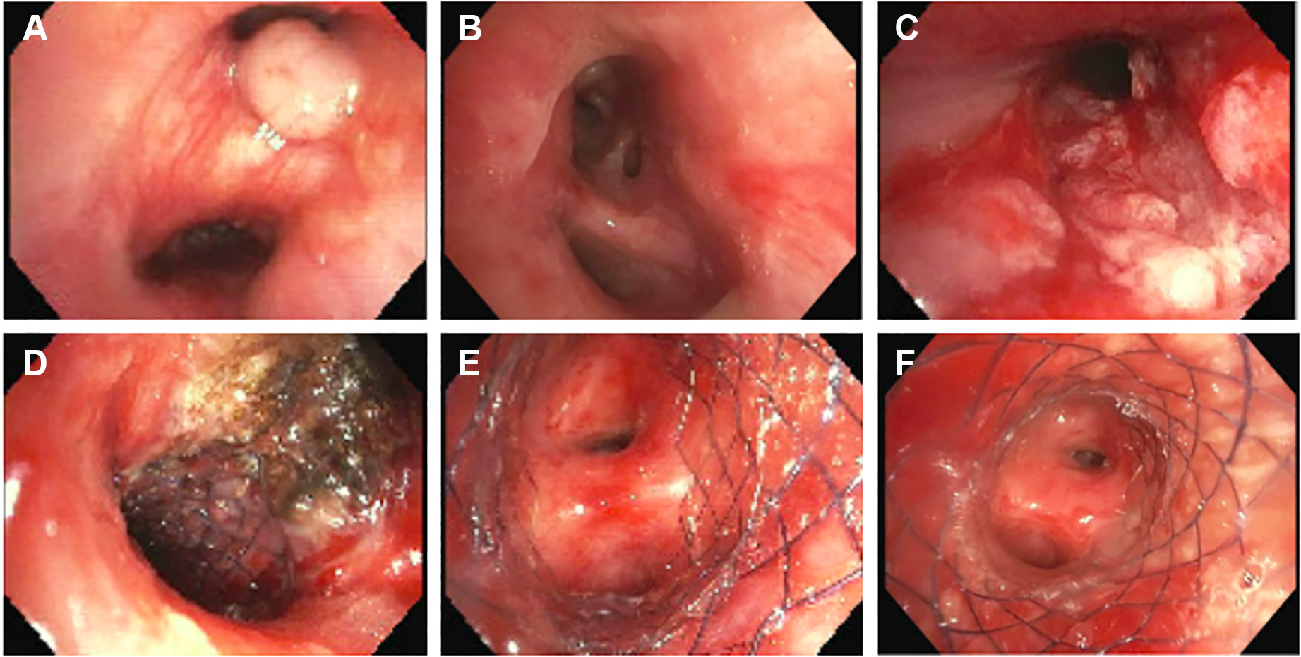 1702958347854132.png 6.png