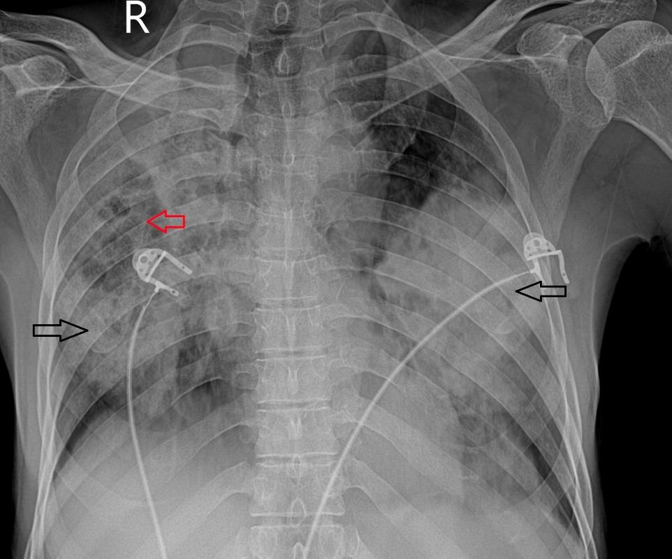 1704879913273399.png 图1.png