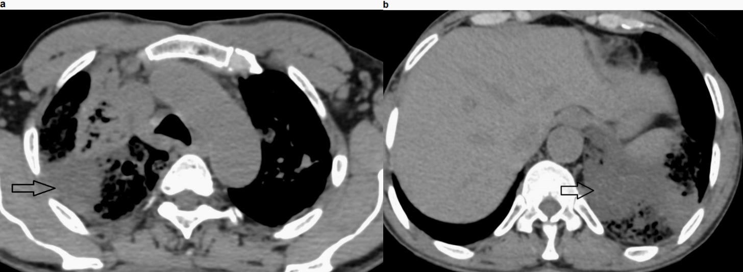 1704879973915283.jpg 图3.jpg